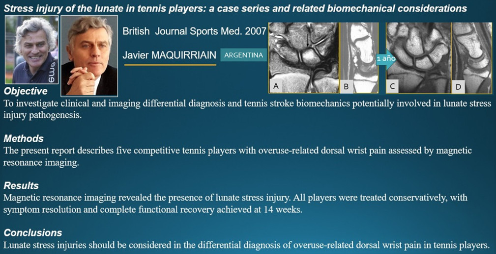 Fig.3. Artículo de  Maquirriain y Ghisi, sobre lesiones por estrés del SE en tenistas.
